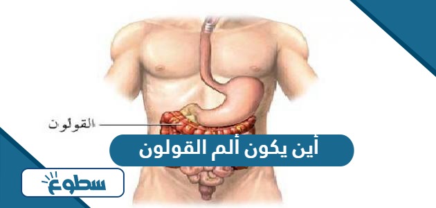 أين يكون ألم القولون